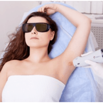 Laser Hari Removal